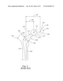 PROSTHETIC FEMORAL STEM FOR USE IN HIGH OFFSET HIP REPLACEMENT diagram and image