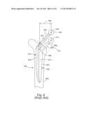 PROSTHETIC FEMORAL STEM FOR USE IN HIGH OFFSET HIP REPLACEMENT diagram and image