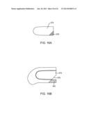 PROSTHETIC FEMORAL STEM FOR USE IN HIGH OFFSET HIP REPLACEMENT diagram and image