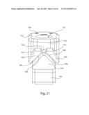 PROSTHETIC FEMORAL STEM FOR USE IN HIGH OFFSET HIP REPLACEMENT diagram and image