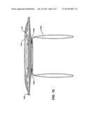 IMPLANTABLE REPAIR DEVICE diagram and image