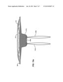 IMPLANTABLE REPAIR DEVICE diagram and image