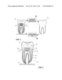 Integrated Support Device For Providing Temporary Primary Stability to     Dental Implants and Prosthesis, and Related Methods diagram and image