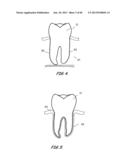 Integrated Support Device For Providing Temporary Primary Stability to     Dental Implants and Prosthesis, and Related Methods diagram and image