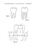 Integrated Support Device For Providing Temporary Primary Stability to     Dental Implants and Prosthesis, and Related Methods diagram and image