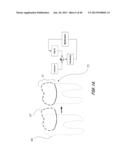 Integrated Support Device For Providing Temporary Primary Stability to     Dental Implants and Prosthesis, and Related Methods diagram and image