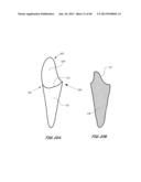 Integrated Support Device For Providing Temporary Primary Stability to     Dental Implants and Prosthesis, and Related Methods diagram and image