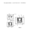 Integrated Support Device For Providing Temporary Primary Stability to     Dental Implants and Prosthesis, and Related Methods diagram and image