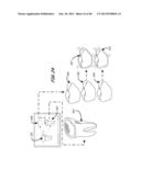 Integrated Support Device For Providing Temporary Primary Stability to     Dental Implants and Prosthesis, and Related Methods diagram and image