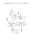 Integrated Support Device For Providing Temporary Primary Stability to     Dental Implants and Prosthesis, and Related Methods diagram and image