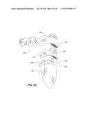 Integrated Support Device For Providing Temporary Primary Stability to     Dental Implants and Prosthesis, and Related Methods diagram and image