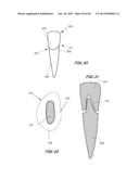 Integrated Support Device For Providing Temporary Primary Stability to     Dental Implants and Prosthesis, and Related Methods diagram and image