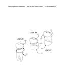 Integrated Support Device For Providing Temporary Primary Stability to     Dental Implants and Prosthesis, and Related Methods diagram and image