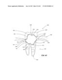 Integrated Support Device For Providing Temporary Primary Stability to     Dental Implants and Prosthesis, and Related Methods diagram and image