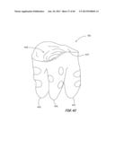 Integrated Support Device For Providing Temporary Primary Stability to     Dental Implants and Prosthesis, and Related Methods diagram and image