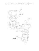 Integrated Support Device For Providing Temporary Primary Stability to     Dental Implants and Prosthesis, and Related Methods diagram and image