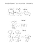 Integrated Support Device For Providing Temporary Primary Stability to     Dental Implants and Prosthesis, and Related Methods diagram and image