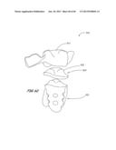 Integrated Support Device For Providing Temporary Primary Stability to     Dental Implants and Prosthesis, and Related Methods diagram and image