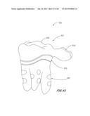 Integrated Support Device For Providing Temporary Primary Stability to     Dental Implants and Prosthesis, and Related Methods diagram and image