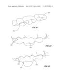 Integrated Support Device For Providing Temporary Primary Stability to     Dental Implants and Prosthesis, and Related Methods diagram and image