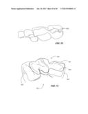 Integrated Support Device For Providing Temporary Primary Stability to     Dental Implants and Prosthesis, and Related Methods diagram and image