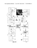 Integrated Support Device For Providing Temporary Primary Stability to     Dental Implants and Prosthesis, and Related Methods diagram and image