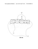 Integrated Support Device For Providing Temporary Primary Stability to     Dental Implants and Prosthesis, and Related Methods diagram and image