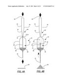 Methods of Making Micro-Abrasive Blasting Device for Dental Applications diagram and image