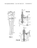 Clamp Mechanism For A Cover Assembly diagram and image