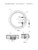 SURGICAL SITE LIGHT diagram and image