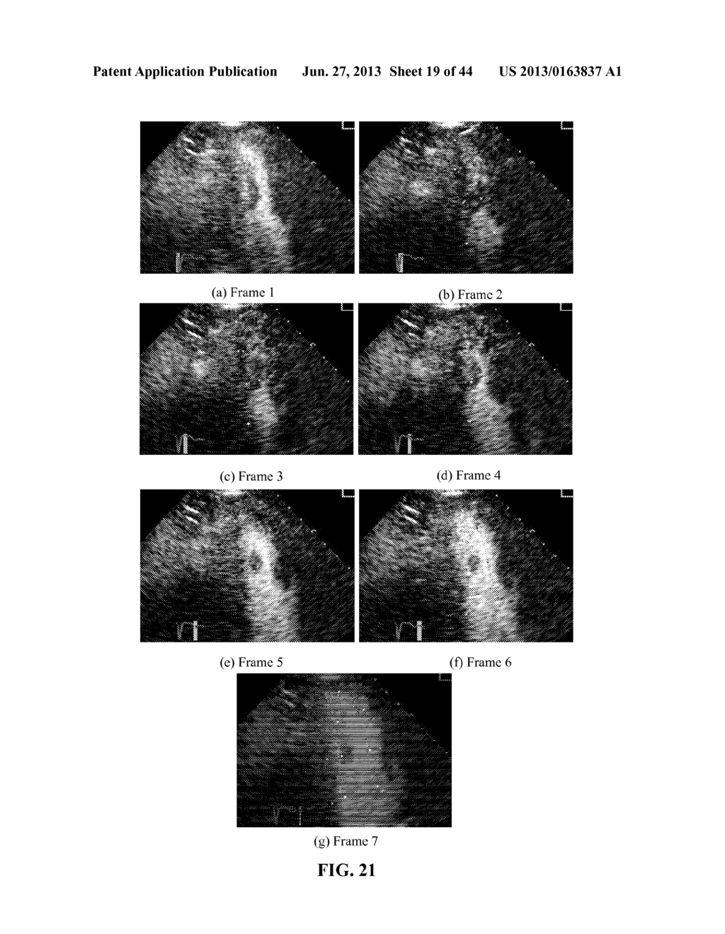 System and Method for Image Sequence Processing - diagram, schematic, and image 20