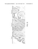 USE OF CAMELID-DERIVED VARIABLE HEAVY CHAIN VARIABLE REGIONS (VHH)     TARGETING HUMAN CD18 AND ICAM-1 AS A MICROBICIDE TO PREVENT HIV-1     TRANSMISSION diagram and image