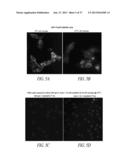 ANTIBODIES TO THE B12-TRANSCOBALAMIN RECEPTOR diagram and image