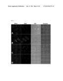 INORGANIC PYROPHOSPHATE AND USES THEREOF diagram and image