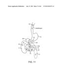 THERAPEUTIC AGENT PREPARATIONS FOR DELIVERY INTO A LUMEN OF THE INTESTINAL     TRACT USING A SWALLOWABLE DRUG DELIVERY DEVICE diagram and image