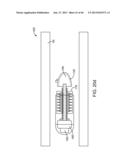 THERAPEUTIC AGENT PREPARATIONS FOR DELIVERY INTO A LUMEN OF THE INTESTINAL     TRACT USING A SWALLOWABLE DRUG DELIVERY DEVICE diagram and image