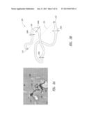 NANOWIRE CATALYSTS AND METHODS FOR THEIR USE AND PREPARATION diagram and image