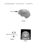 BRAIN STATE SUPPORT APPARATUS AND PROGRAM diagram and image