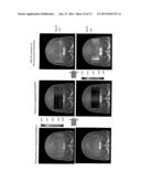 BRAIN STATE SUPPORT APPARATUS AND PROGRAM diagram and image