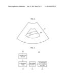 PROVIDING MOTION MODE IMAGE IN ULTRASOUND SYSTEM diagram and image