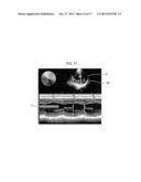 PROVIDING MOTION MODE IMAGE IN ULTRASOUND SYSTEM diagram and image