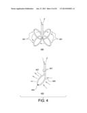 Mechanical Wound Therapy for Sub-Atmospheric Wound Care System diagram and image