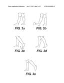 ORTHOSIS AND METHOD OF USE FOR TREATMENT AND REHABILITATION OF DROPFOOT diagram and image