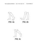 ORTHOSIS AND METHOD OF USE FOR TREATMENT AND REHABILITATION OF DROPFOOT diagram and image