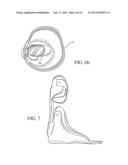 Dynamic Exoskeletal Orthosis diagram and image