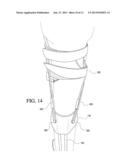 Dynamic Exoskeletal Orthosis diagram and image