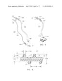 Rotate-to-Advance Catheterization System diagram and image