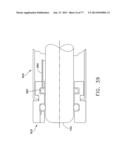 Rotate-to-Advance Catheterization System diagram and image