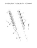 Rotate-to-Advance Catheterization System diagram and image