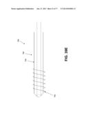 Rotate-to-Advance Catheterization System diagram and image